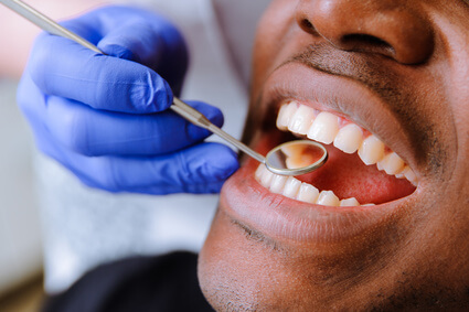 dentist for practices wearing glove holding small mirror in patient's mouth